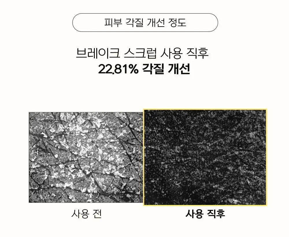 [국가대표PICK/인그로운헤어] 디어도어 비건 저자극 바디스크럽 300ml 3종 택1 상세페이지 43